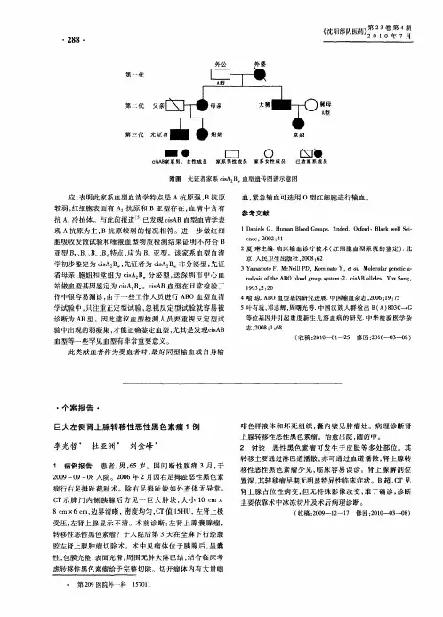 巨大左侧肾上腺转移性恶性黑色素瘤1例