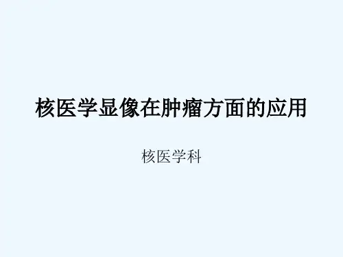 核医学显像在肿瘤方面的应用