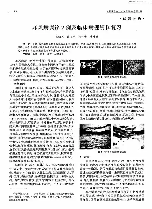 麻风病误诊2例及临床病理资料复习