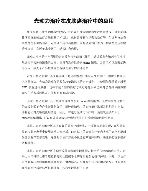 光动力治疗在皮肤癌治疗中的应用