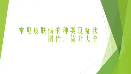 最新最新常见皮肤病的种类及症状图片、简介大全-医学课件