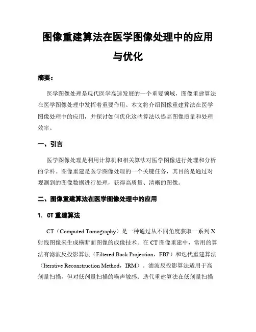 图像重建算法在医学图像处理中的应用与优化