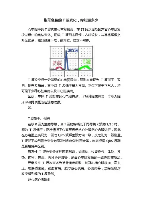 形形色色的T波变化，你知道多少