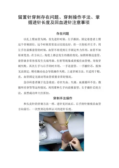 留置针穿刺存在问题、穿刺操作手法、掌握进针长度及回血进针注意事项