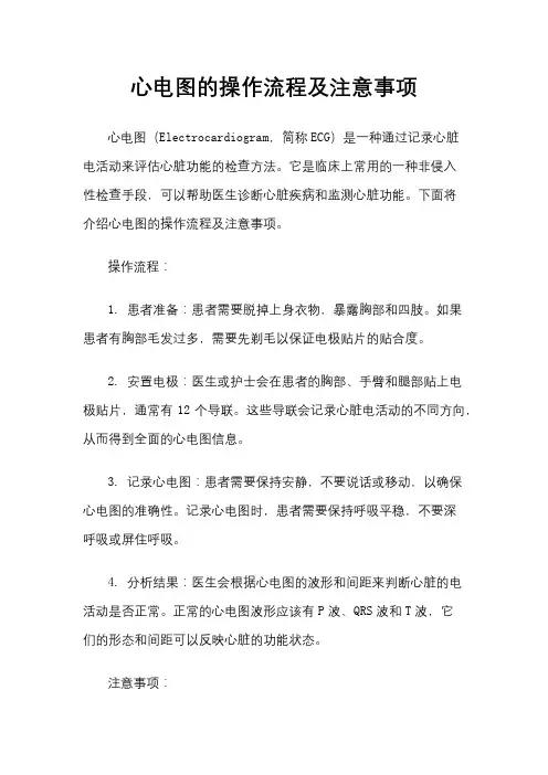 心电图的操作流程及注意事项