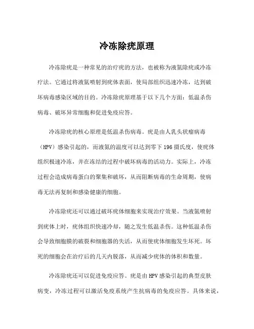 冷冻除疣原理