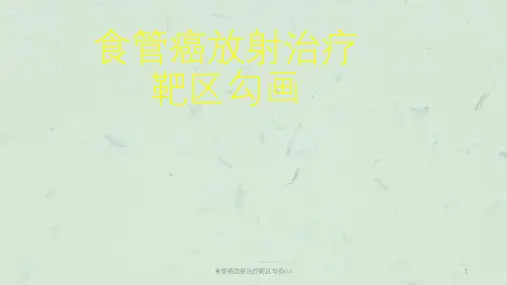 食管癌放射治疗靶区勾画cui课件