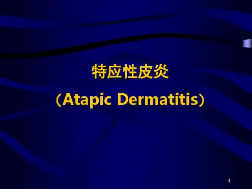 特应性皮炎精选课件