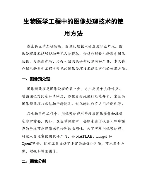 生物医学工程中的图像处理技术的使用方法