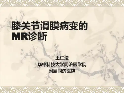 膝关节滑膜病变的MR诊断ppt课件