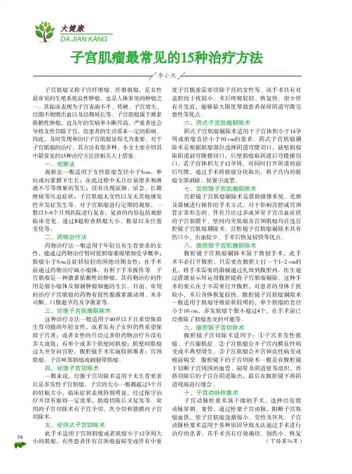 子宫肌瘤最常见的15种治疗方法
