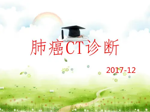 肺癌CT诊断