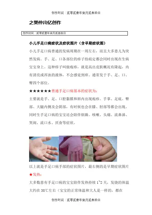 小儿手足口病症状及症状图片