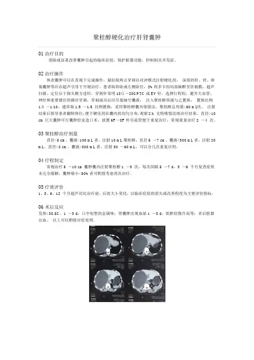聚桂醇硬化囊肿治疗