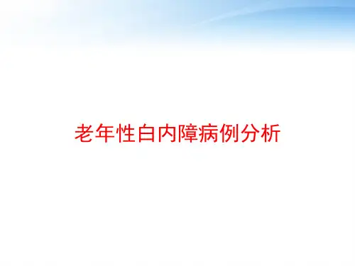 老年性白内障病例分析 ppt课件