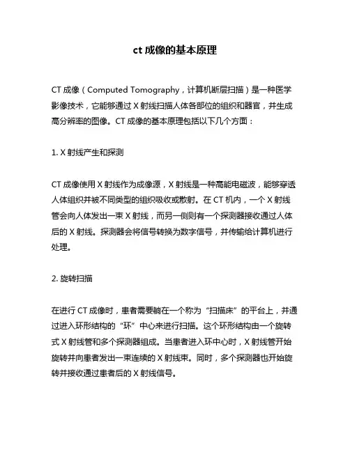 ct成像的基本原理