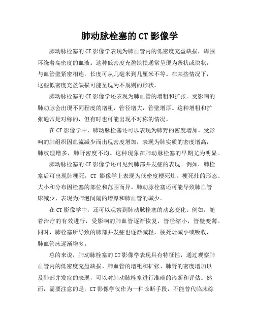 肺动脉栓塞的CT影像学