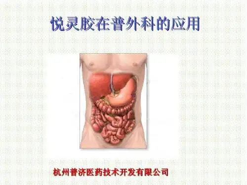 普外科应用